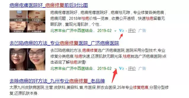 一个年入50万的正规赚钱项目,祛疤产品竟然如此暴利